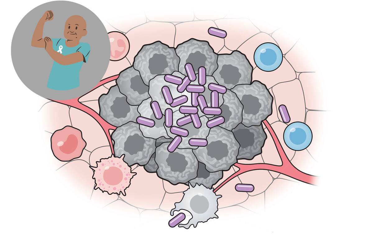 Desarrollan vacuna bacteriana que puede suprimir el cáncer en ratones y detiene la metástasis