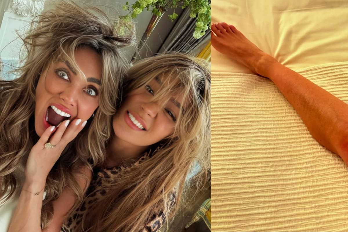 Anahí revela los moretones que le dejó su intensa “pelea” con Karol G en el promo de su nuevo álbum