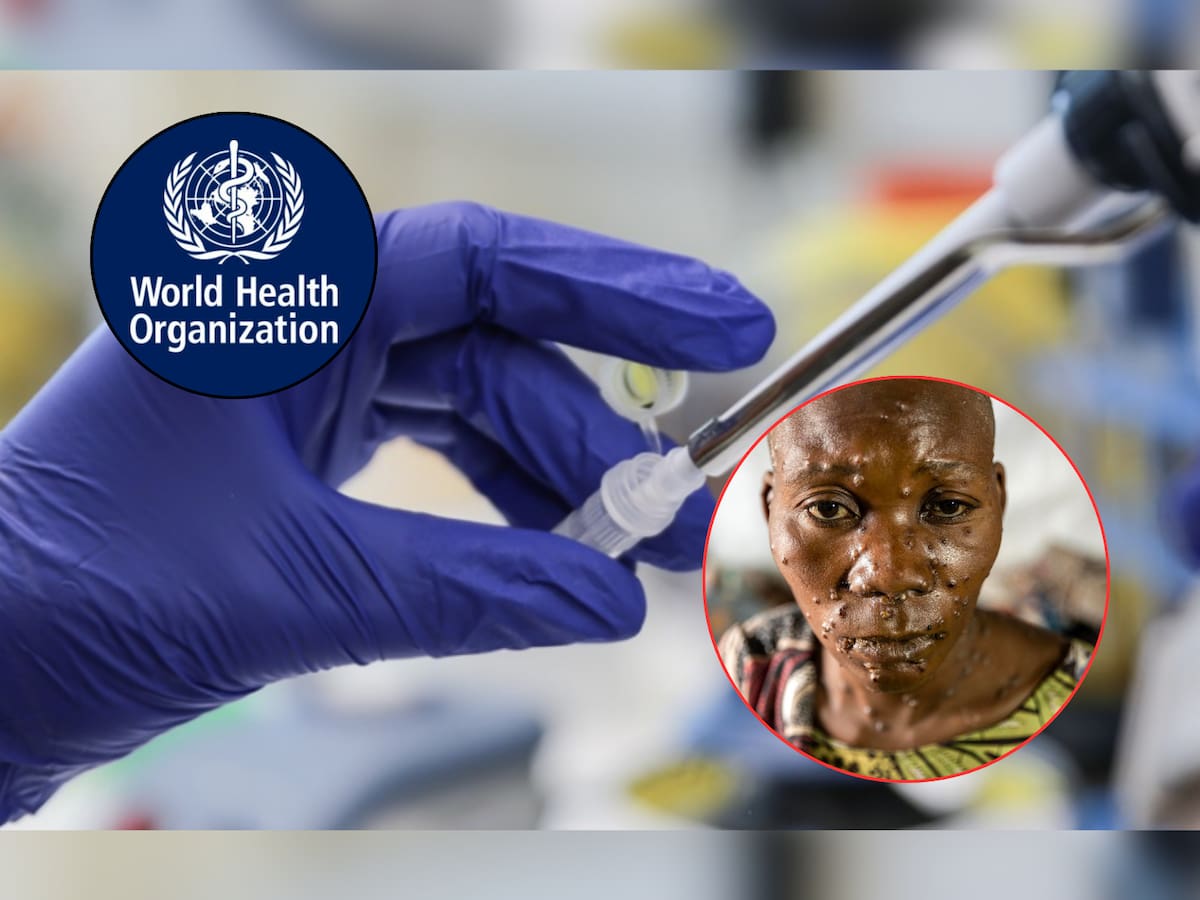 ¡Ya hay vacuna para la viruela del mono (Mpox)! | Crédito: OMS/EFE