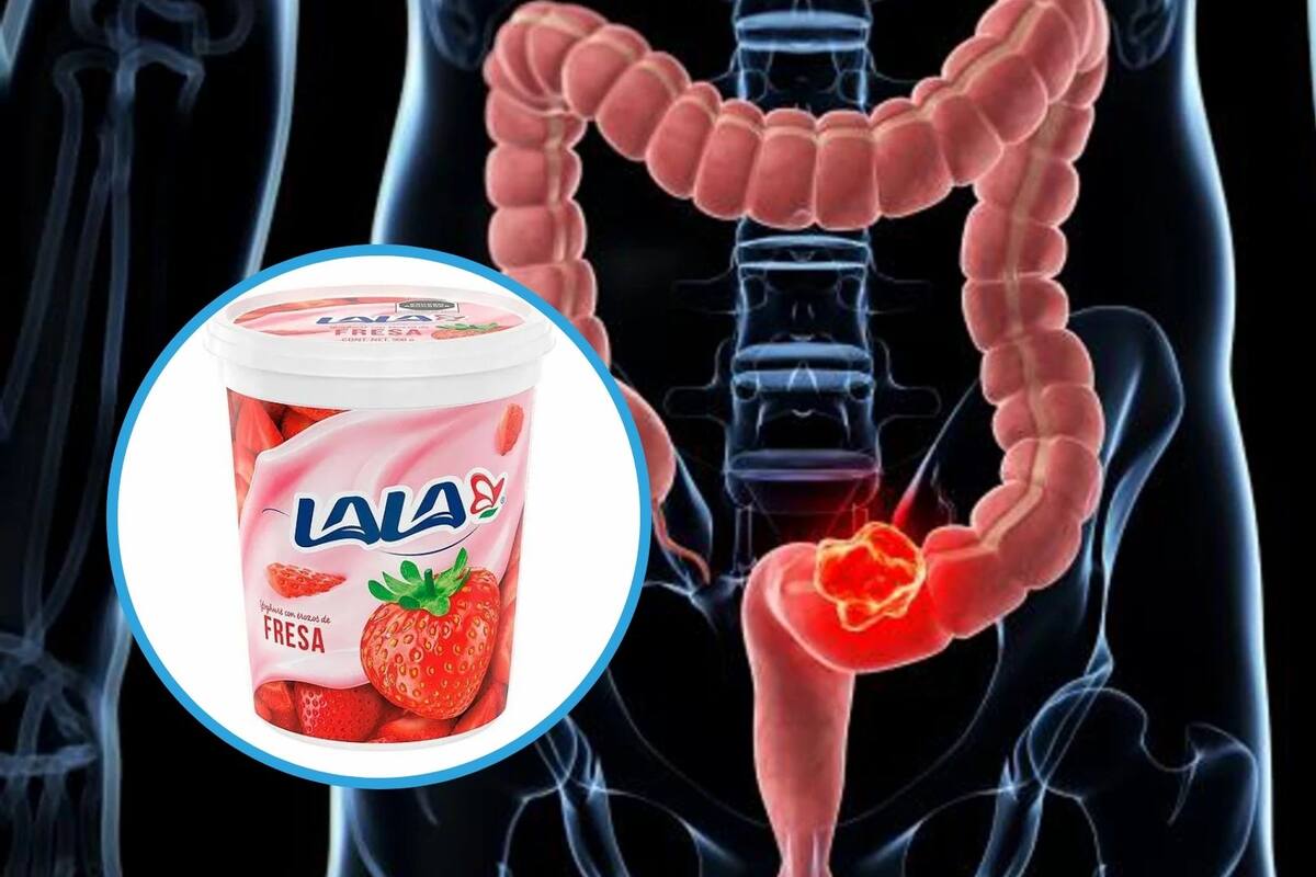 Yogurt de fresa Lala podría causar cáncer de cólon según El Poder Del Consumidor A.C.