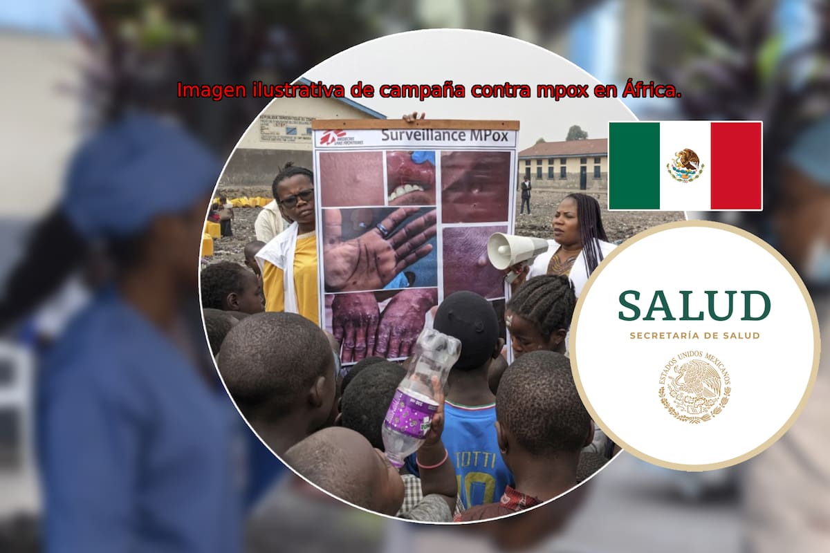 Casos viruela del mono en México: ¿Cuántos contagios de mpox y en qué estados reporta Salud en 2024?