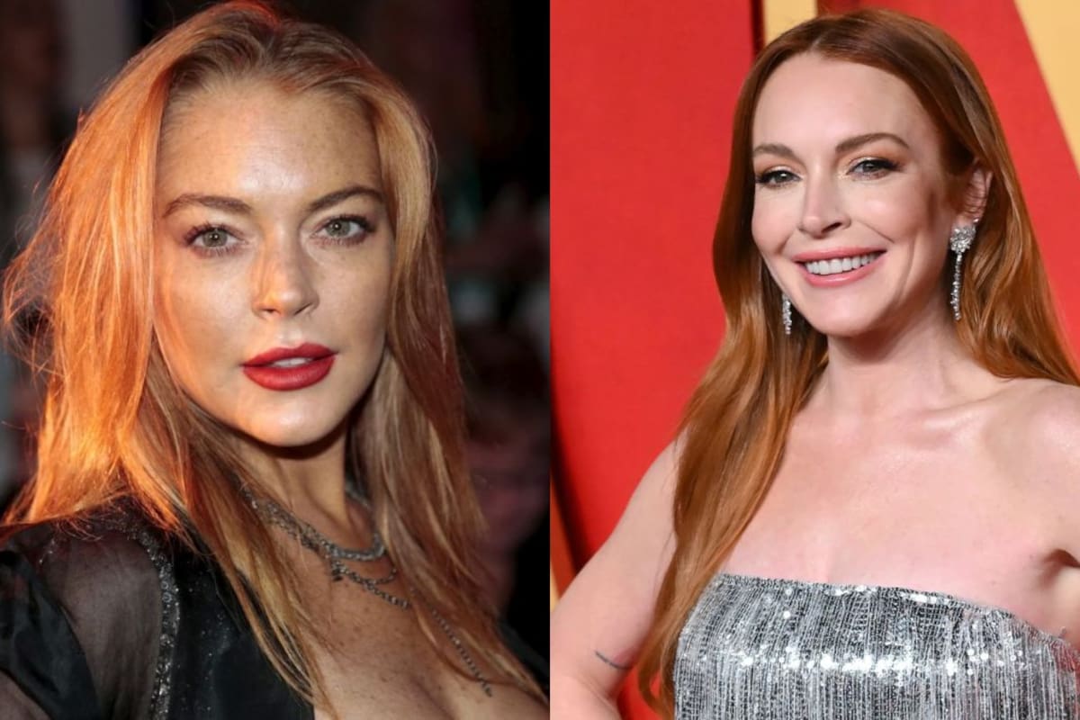 ¿Qué se están haciendo las famosas en la cara? El nuevo secreto de rejuvenecimiento en Hollywood