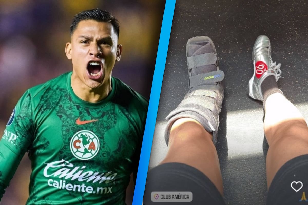 Preocupa lesión de Luis Ángel Malagón tras publicar foto con bota ortopédica antes de la Liguilla