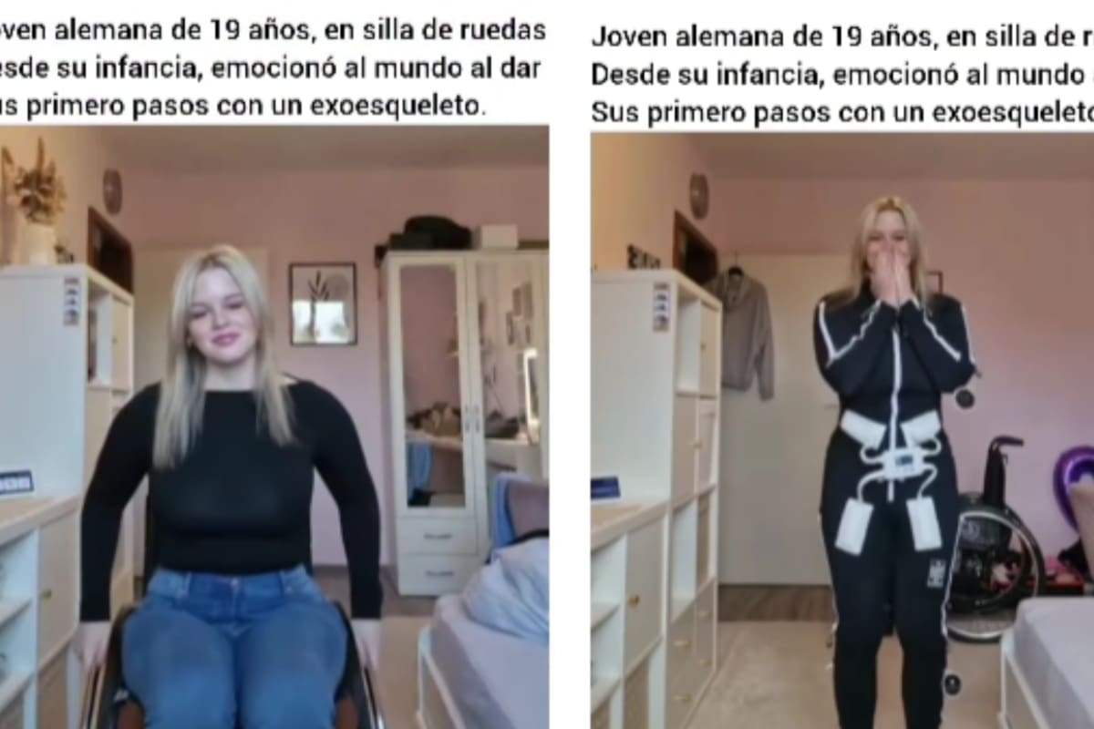 Joven que pasó 19 años en silla de ruedas logra ponerse de pie por primera vez gracias a un exoesqueleto