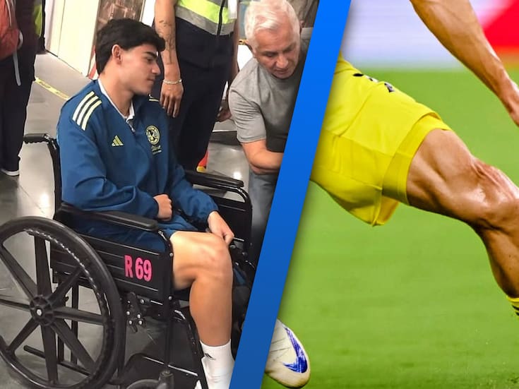 ¿Cuánto tiempo tardará en recuperarse Dagoberto Espinoza del América?