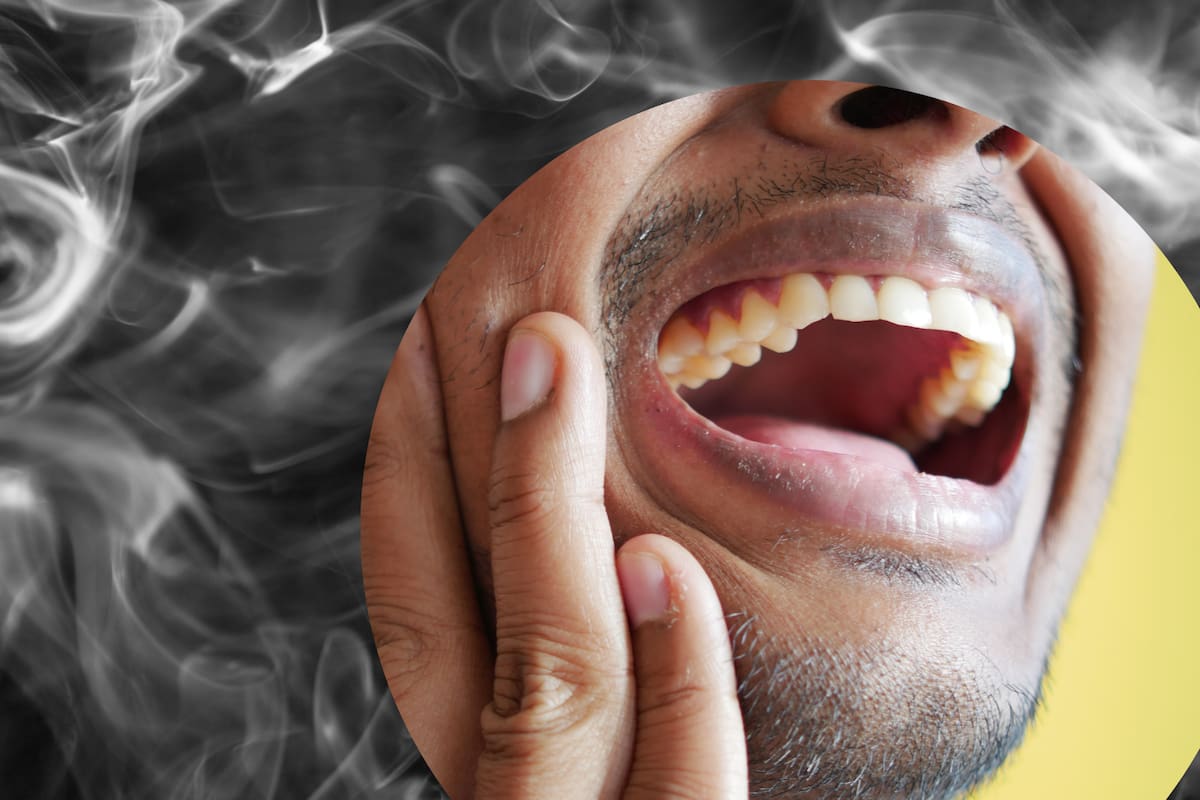 El vapeo puede causar daño irreversible en las encías, según nuevo estudio