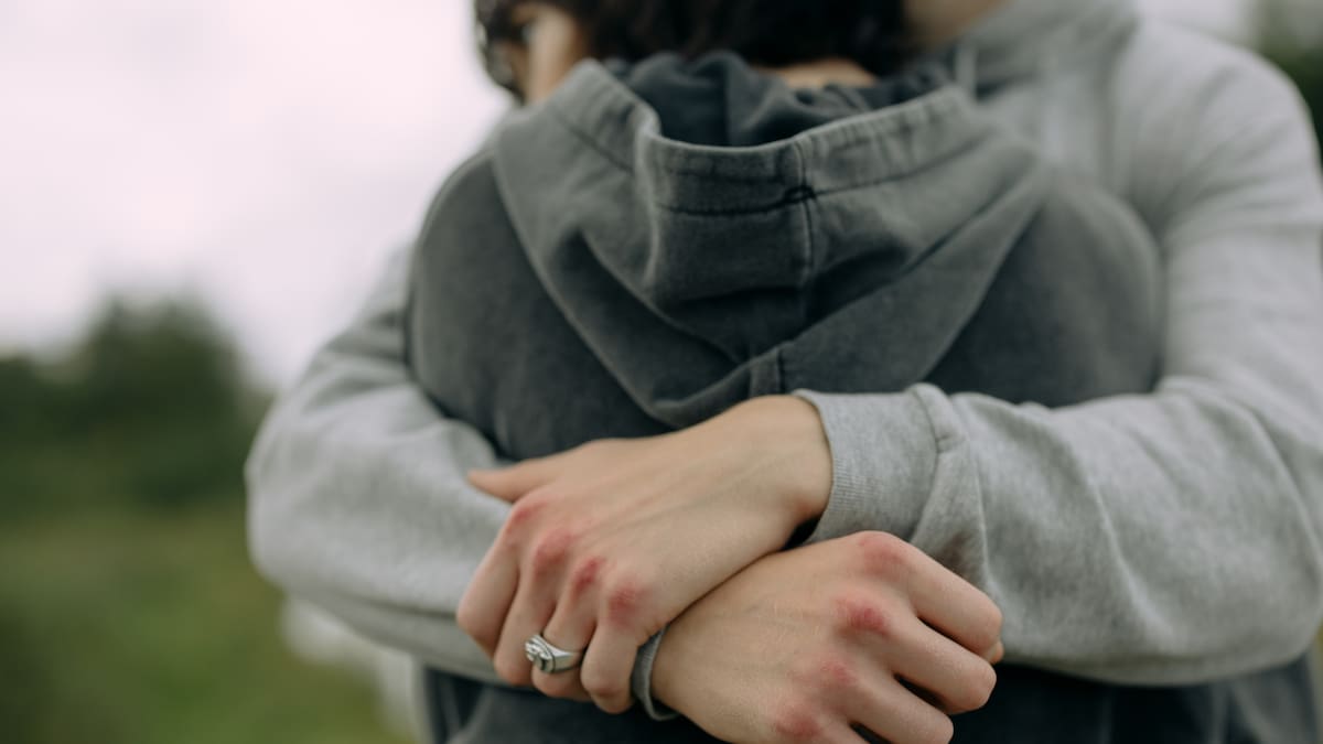 Abrazo. Foto: Archivo
