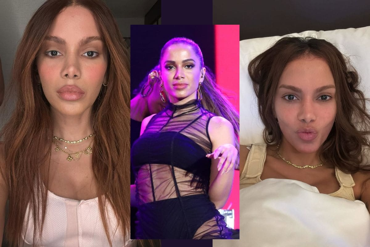 Anitta reaparece con rostro transformado y usuarios la comparan con Michael Jackson