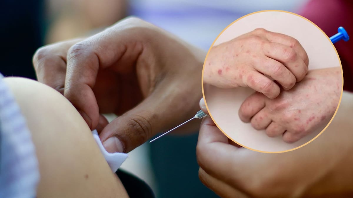 ¿Quiénes se pueden vacunar contra el sarampión ante el incremento de contagios en Baja California?