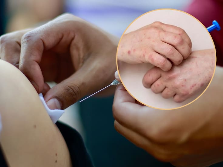 ¿Quiénes se pueden vacunar contra el sarampión ante el incremento de contagios en Baja California?