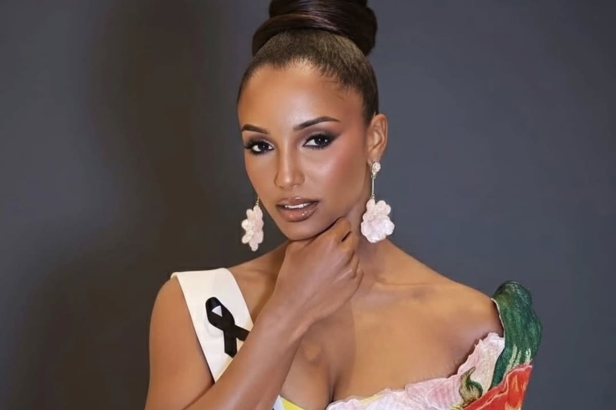 Miss Jamaica sigue hospitalizada: “Está cerca de recibir el alta”