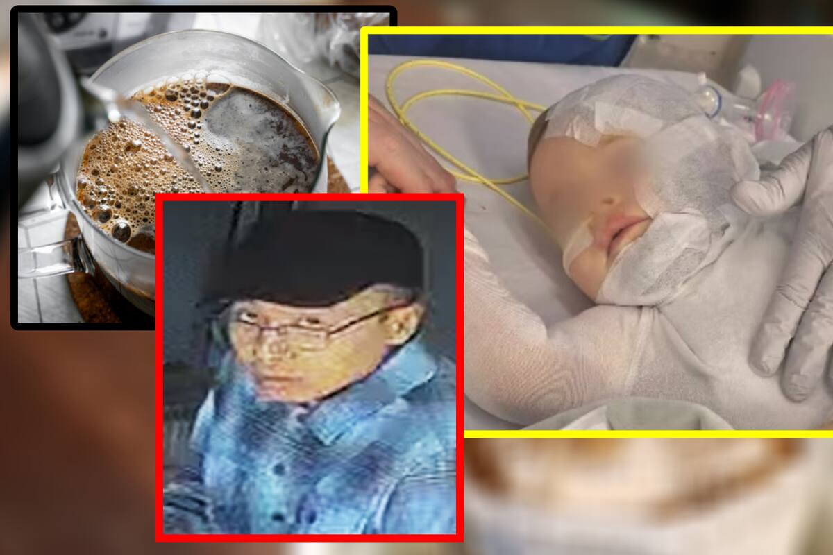 Hombre tiró café hirviendo a bebé de 9 meses y huyó del país; lo dejó con “quemaduras graves” en todo el cuerpo