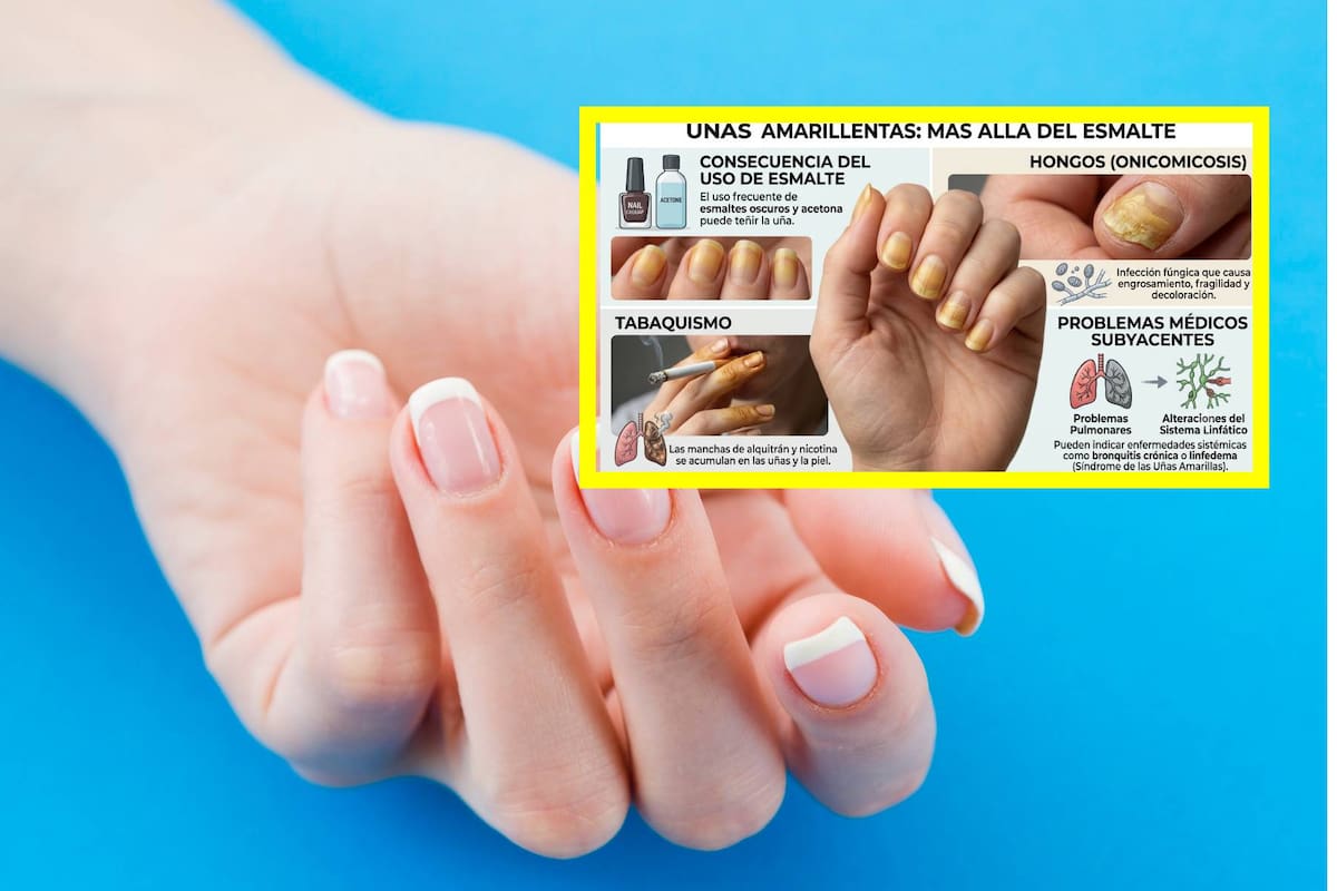 ¿Sabías que tus uñas pueden dar pistas sobre tu salud?