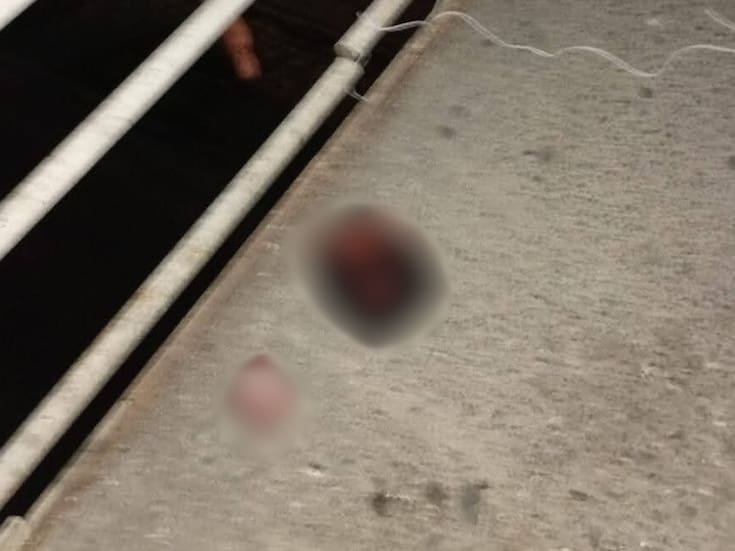 Abandonan manta y restos humanos en un puente peatonal