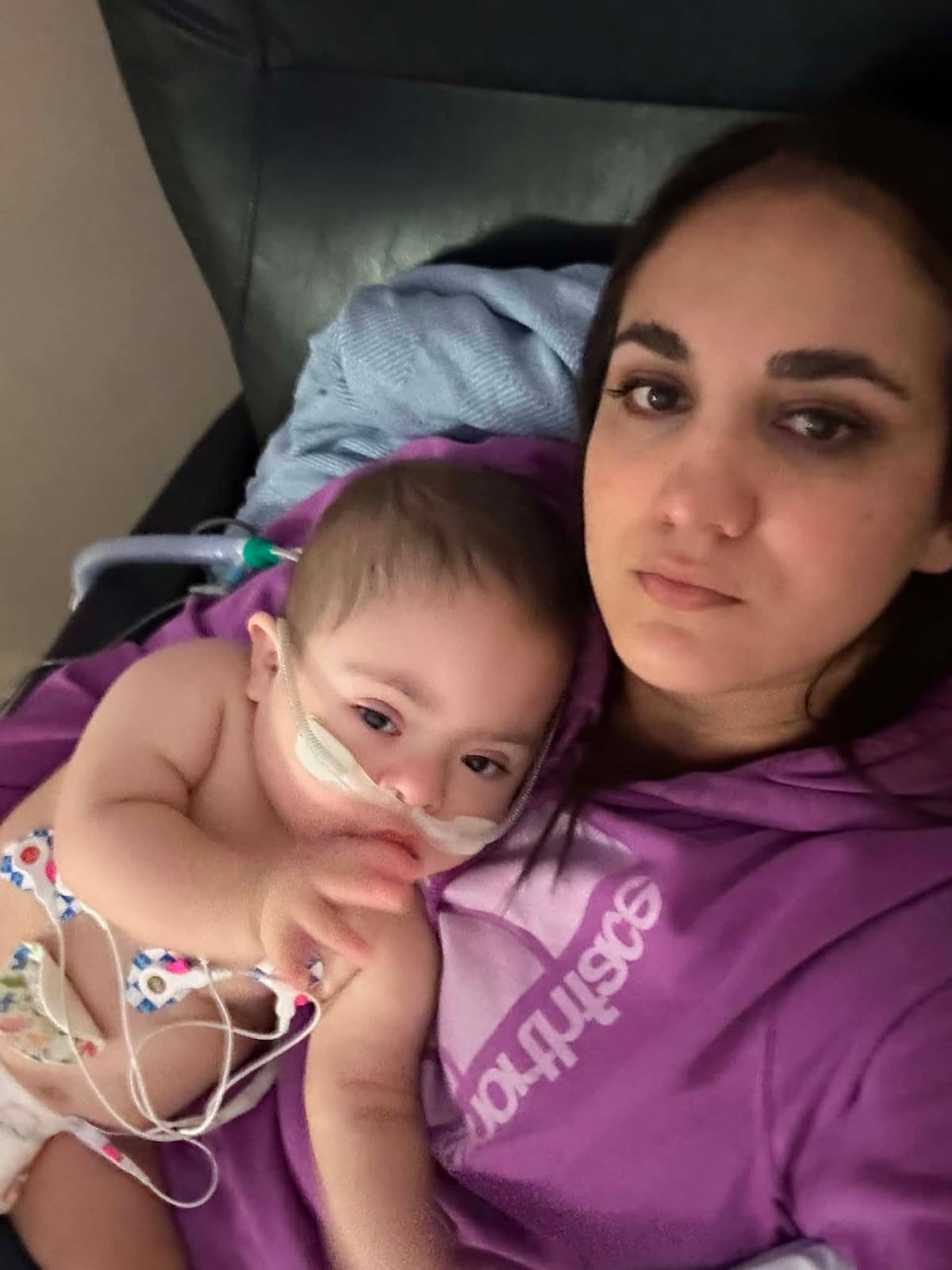 Matías presenta complicaciones derivadas del Síndrome de Down. Foto: Cortesía