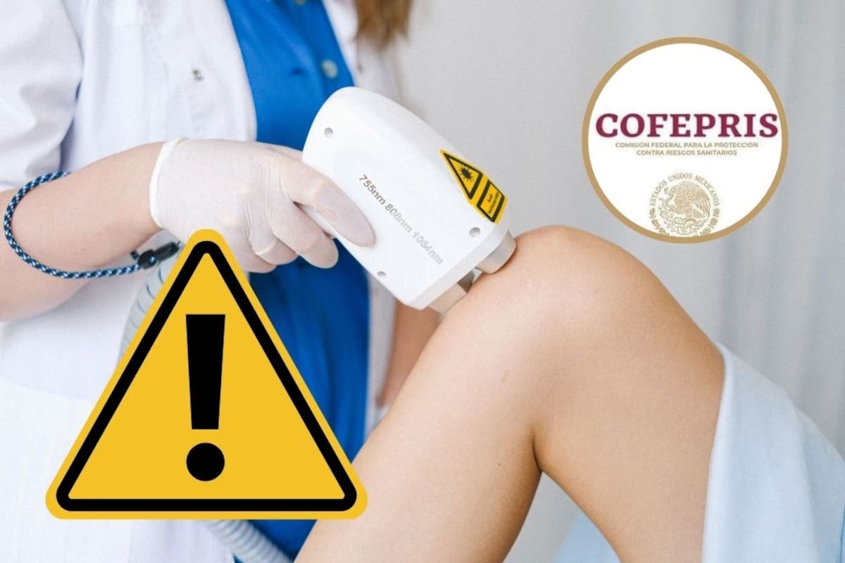 Cofepris emite alerta nacional por depiladoras IPL falsificadas en internet debido al riesgo de sufrir quemaduras graves, cicatrices e infecciones permanentes en la piel