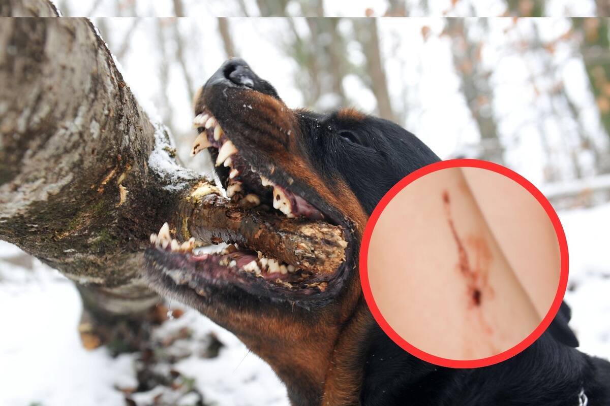 Ataques de perros dejan dos lesionados en Nogales