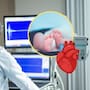 Sonora aprueba reforma a la Ley de Salud para detectar problemas cardiacos en recién nacidos: qué es el tamiz cardiológico, cuándo se realiza y dónde solicitarlo