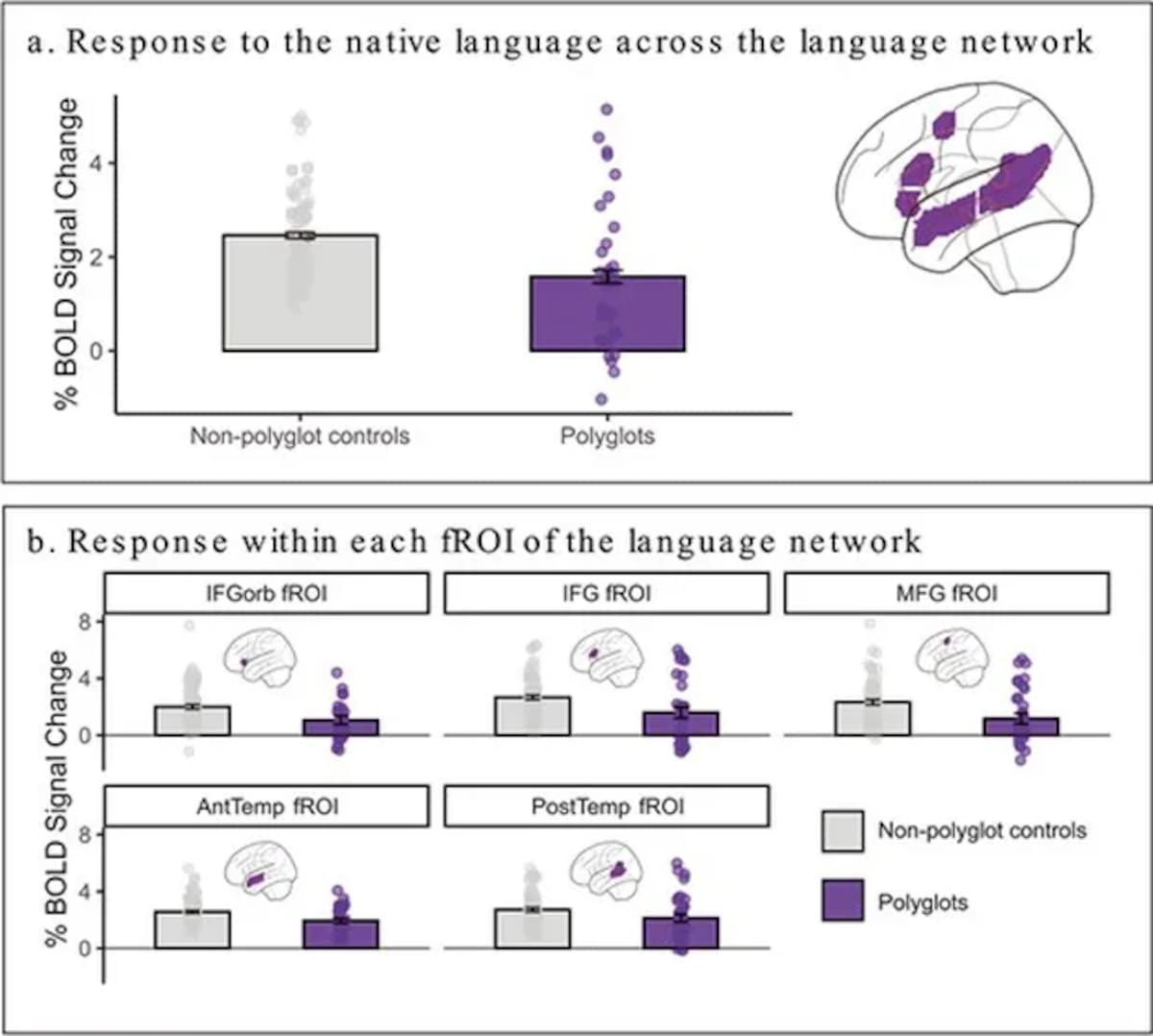 Respuesta cerebral de los políglotas y hablantes de un idioma. Foto: Universidad de Oxford / Milenio