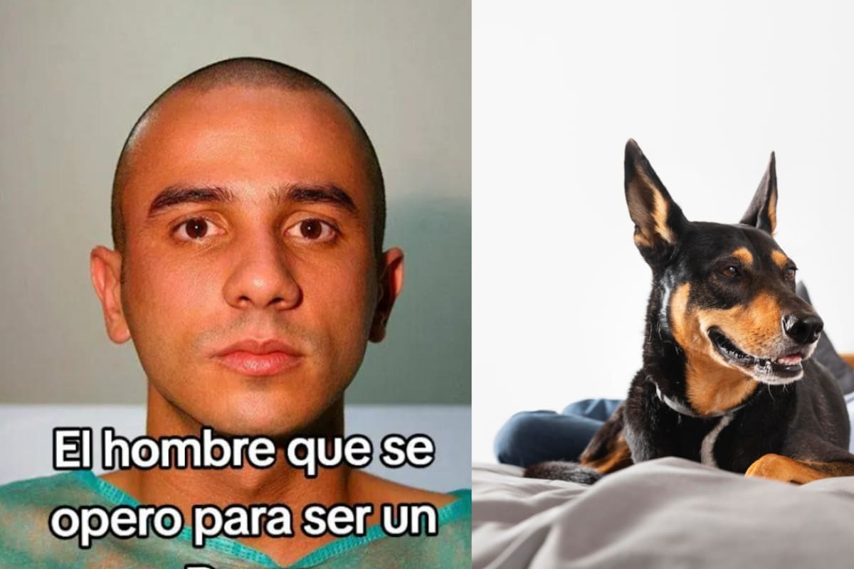 Artista plástico se somete a cirugía para parecerse a un perro; el resultado es impactante