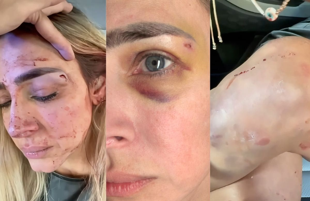 Conductora Edna Monroy muestra en video las lesiones por estrangulamiento tras ser agredida por su expareja, el cuñado de Jacky Bracamontes