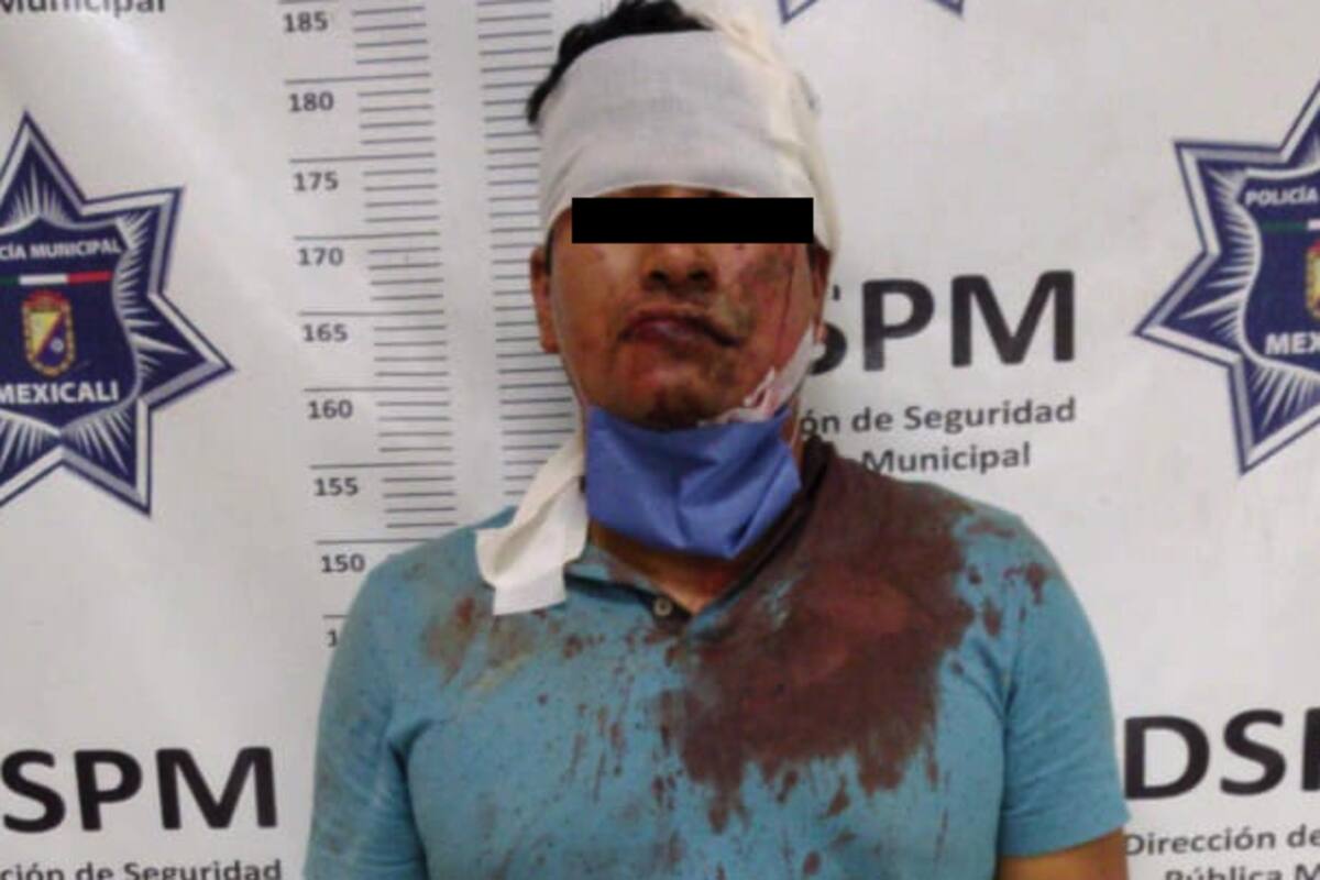 Fallido homicida es golpeado por víctima en la colonia El Refugio