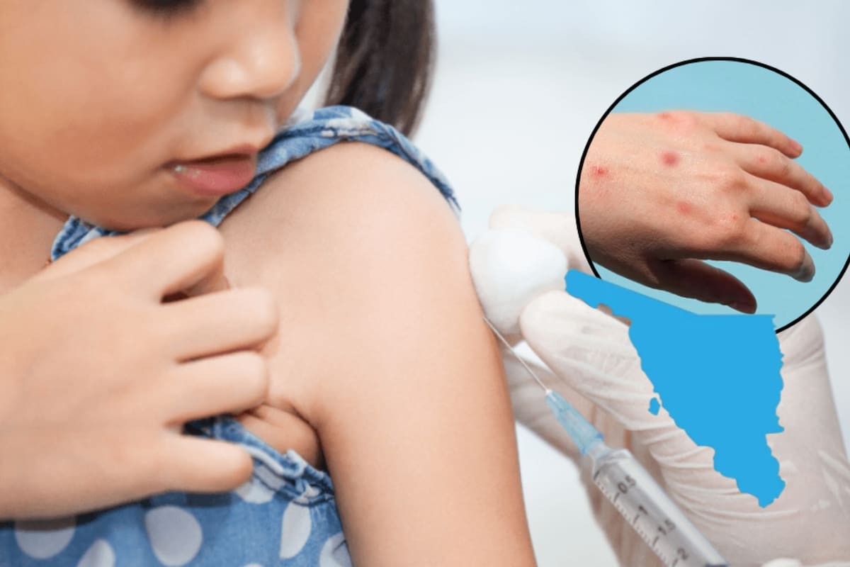 Sonora entre los estados con más sarampión en México: suma 269 casos en 2026