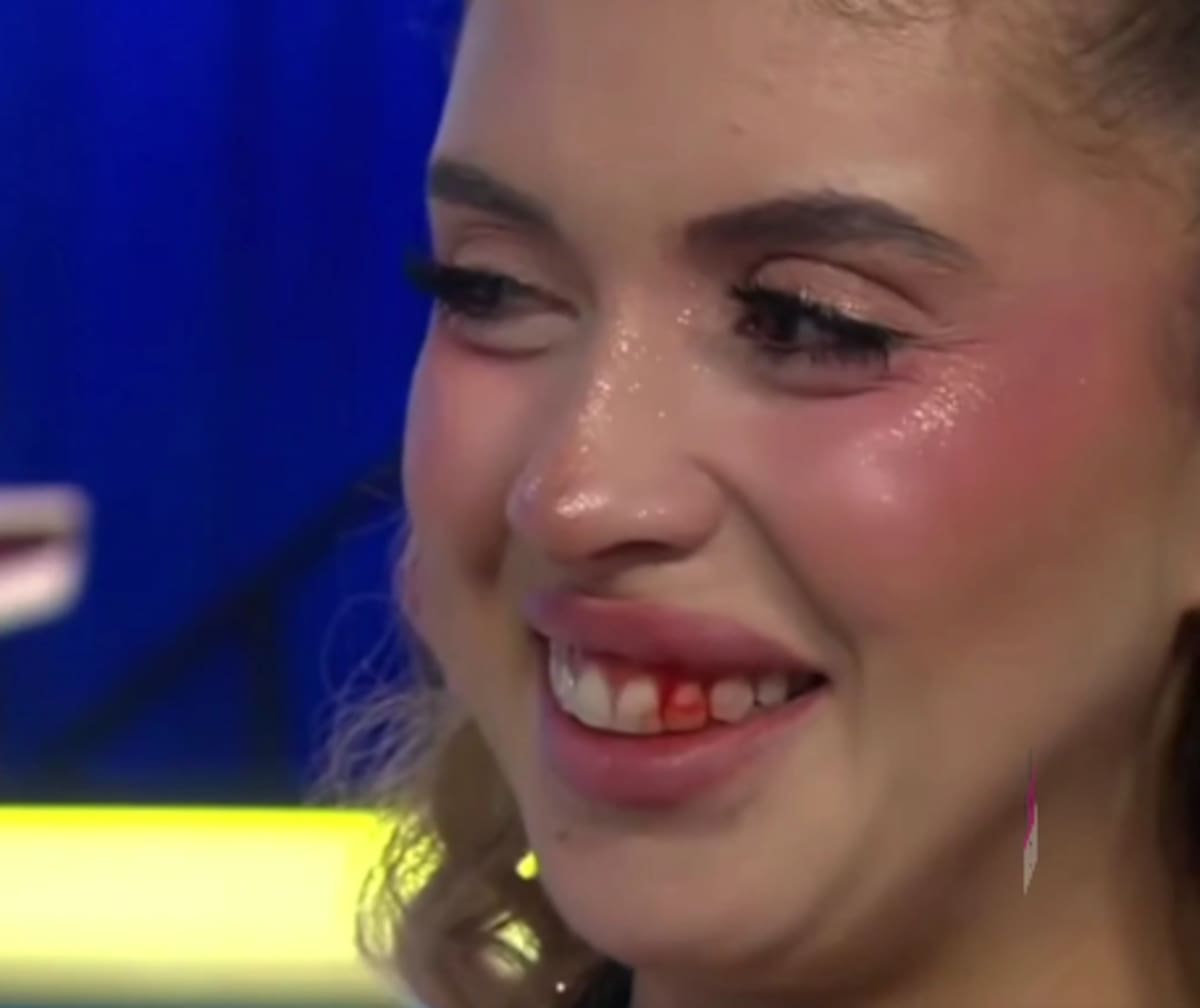 Así fue como quedó la boca de la modelo.
