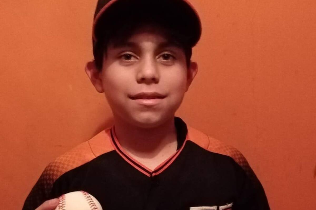 Día Internacional de las Malformaciones Congénitas: Xavier Alexander es ¡imparable!