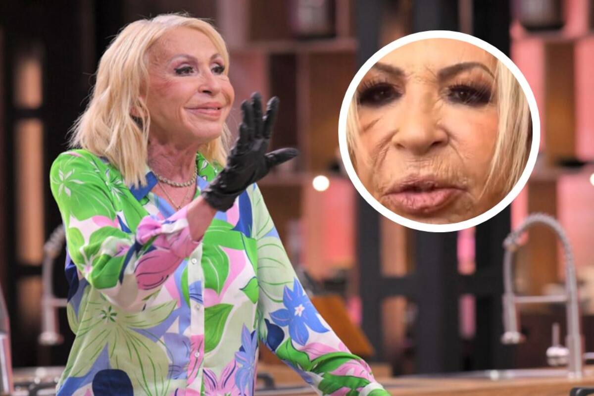 Laura Bozzo se hará una ritidectomía para rejuvenecer su rostro “Despídanse de esta cara de momia”
