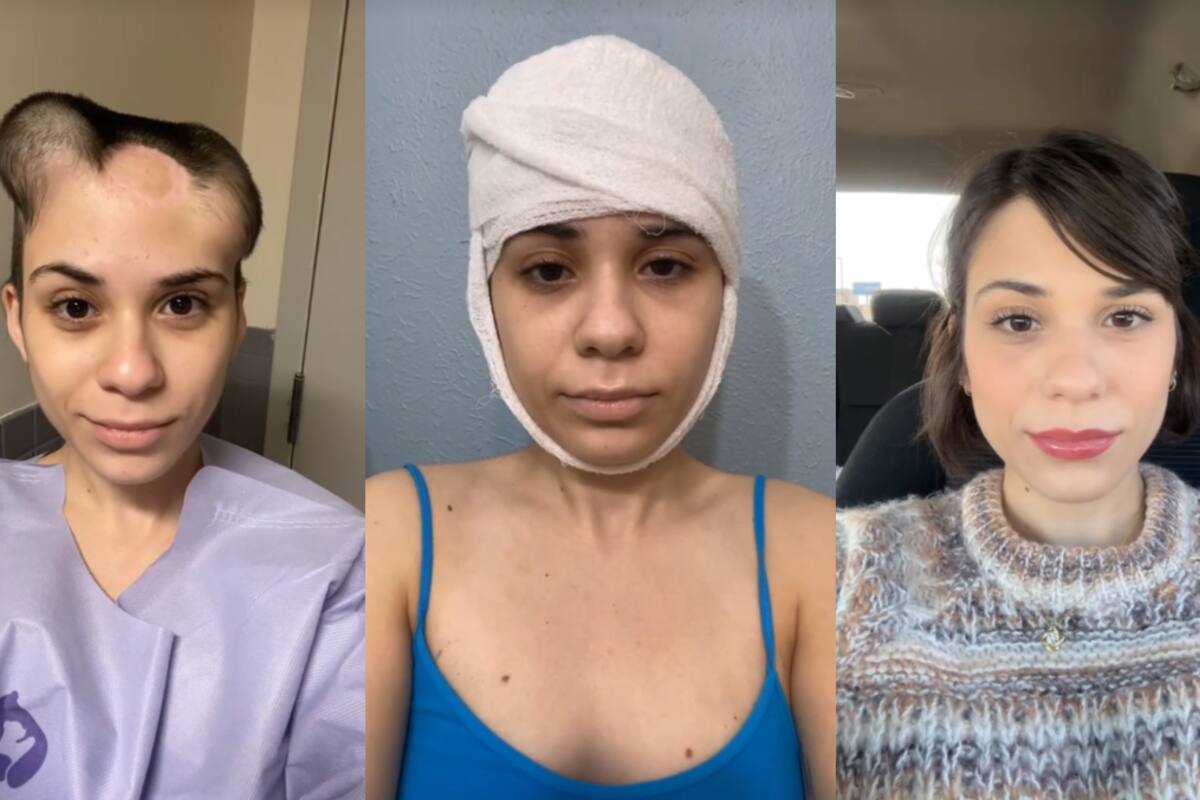 Sobreviviente de cáncer se vuelve viral por su impresionante transformación
