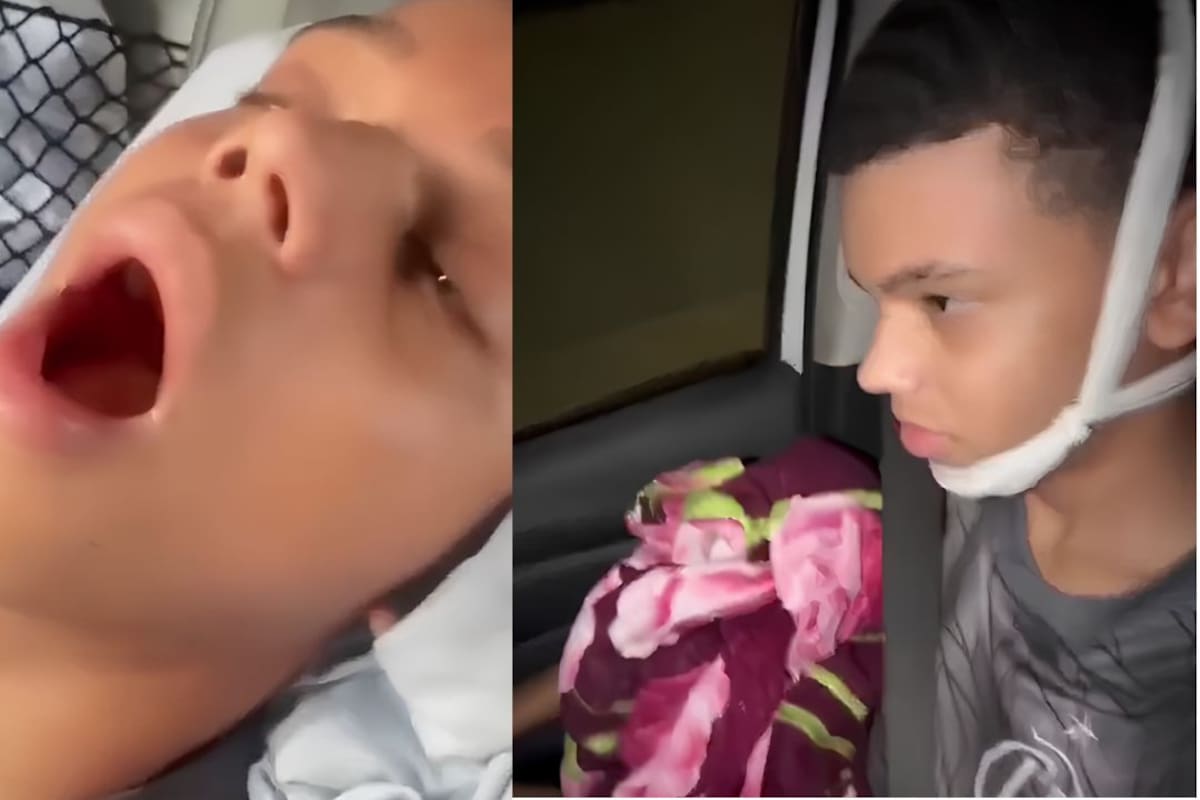 Adolescente de 14 años terminó en el hospital tras bostezar: Así su mandíbula quedó bloqueada