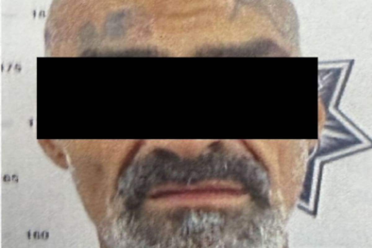 Acusan a hombre de mutilar el rostro de un joven con un machete en SLRC