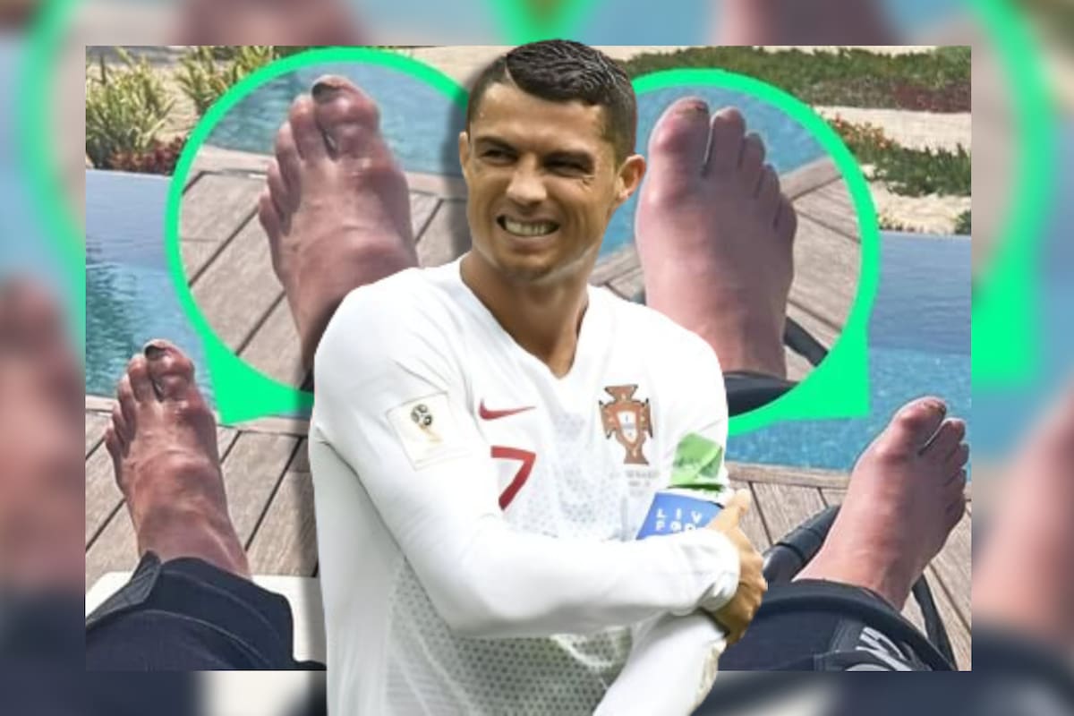 Foto de pies de Cristiano Ronaldo desata sentimientos encontrados y hasta preocupación en redes