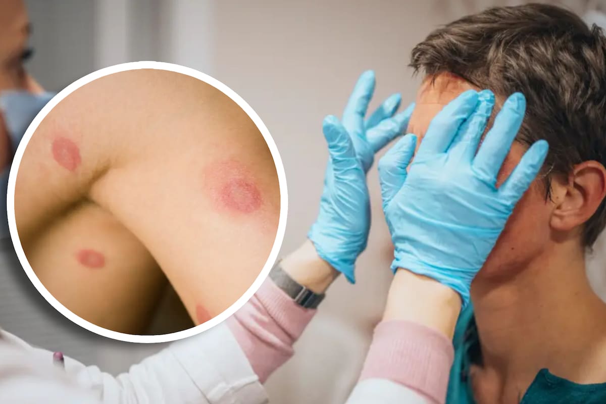 Nueva ETS llega a EU: Hongos altamente contagiosos