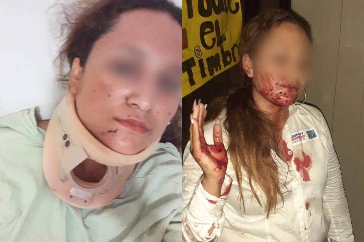 Adulto mayor golpea con un bastón a candidata del PAN en San Luis Potosí