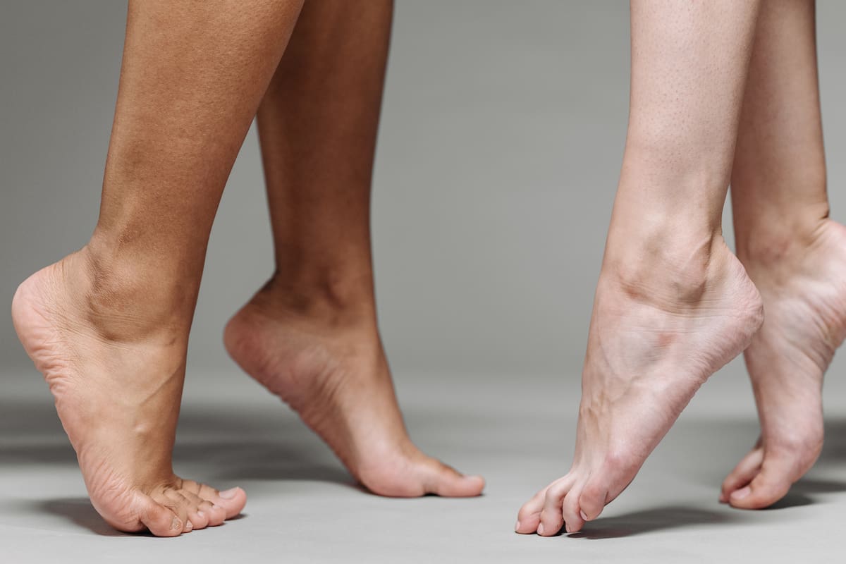 Este problema común en los pies es en realidad una ‘deformidad compleja’ — y puede causar complicaciones si se ignora