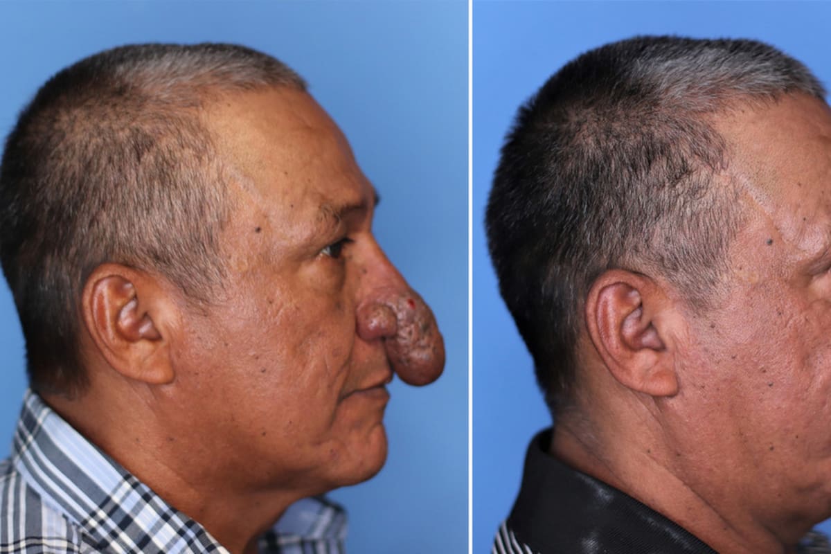 Cirujano plástico regala reconstrucción facial a un obrero que trabajaba en su casa