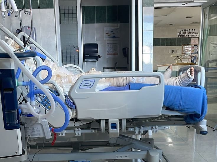 Trasladan a hombre con quemaduras graves de Tijuana a Chihuahua; familia pide apoyo