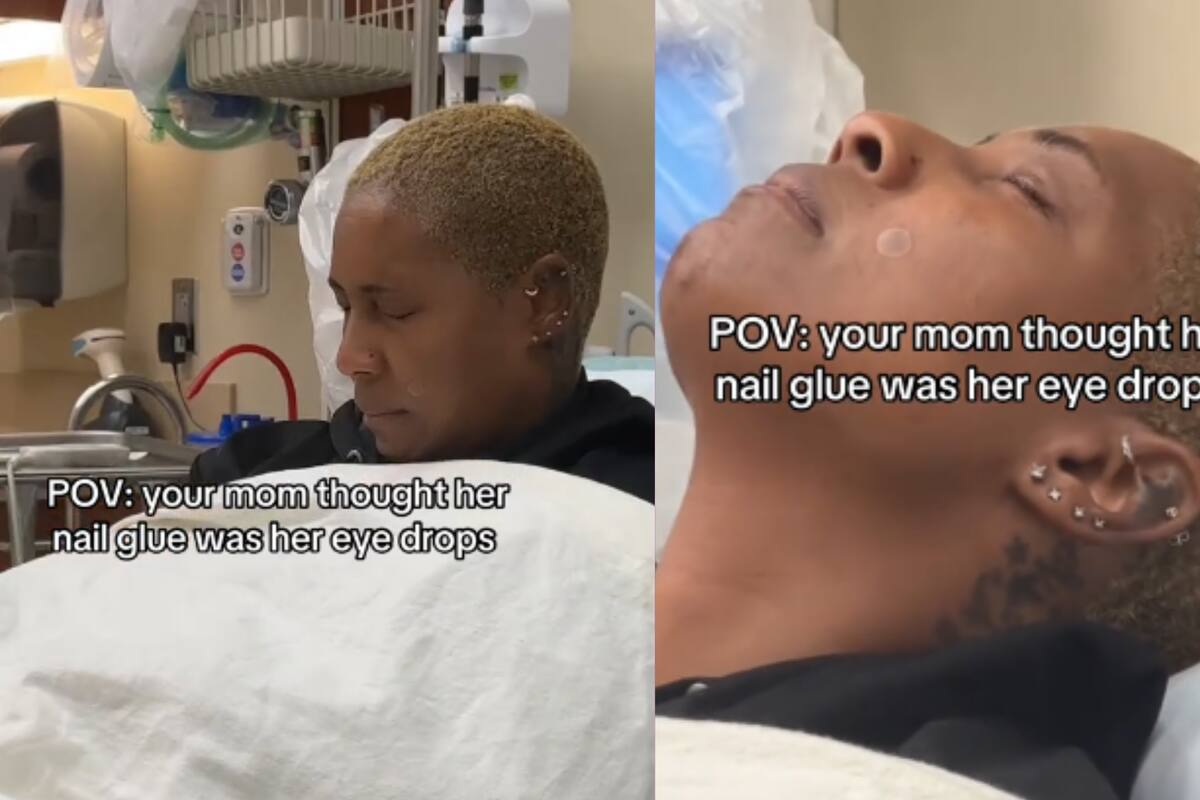 Mujer termina en el hospital tras confundir pegamento para uñas con gotas para los ojos