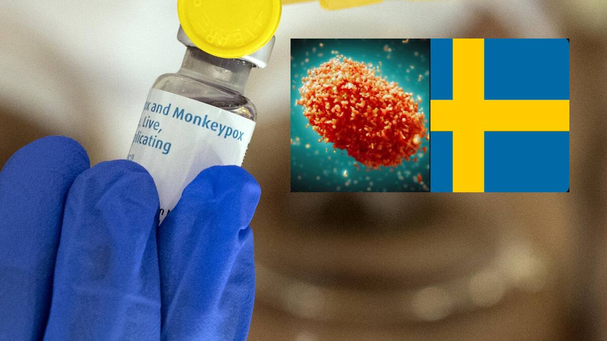 Mpox, viruela del mono, fue detectada en Suecia en su variante Clade 1. | EFE