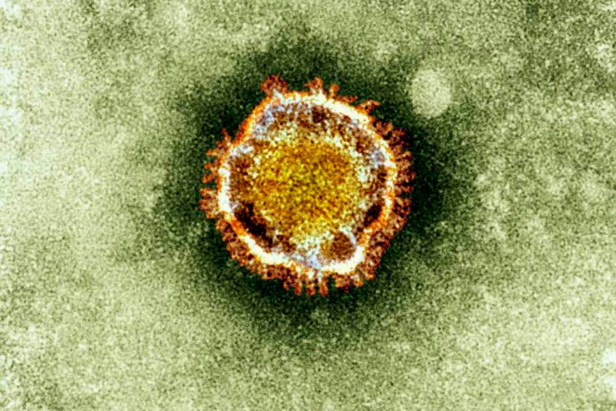 EU y Francia evacuan a sus ciudadanos de Wuhan tras brote de coronavirus