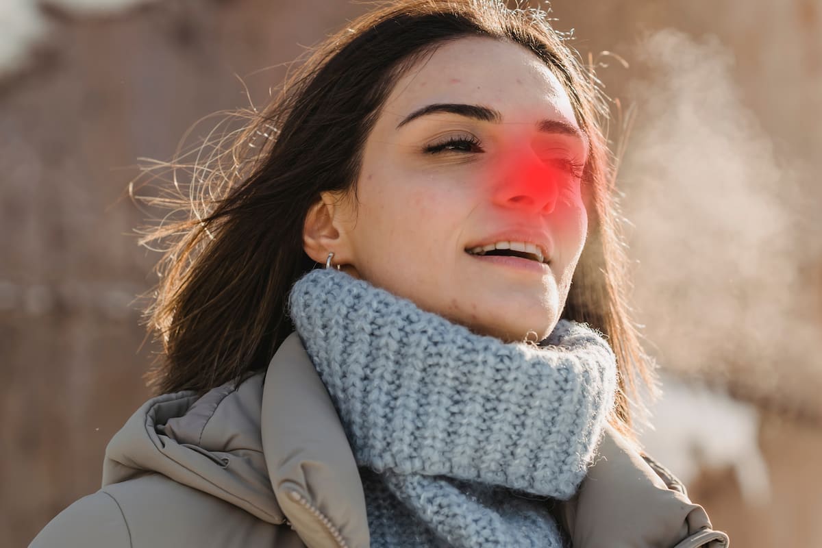 El “signo de la nariz roja de Rudolph” es una pista de que tienes esta infección nasal, que es más común en invierno