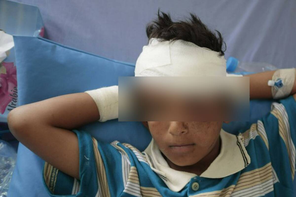 Más de 7.500 niños han muerto en Yemen por bombardeos: ONU