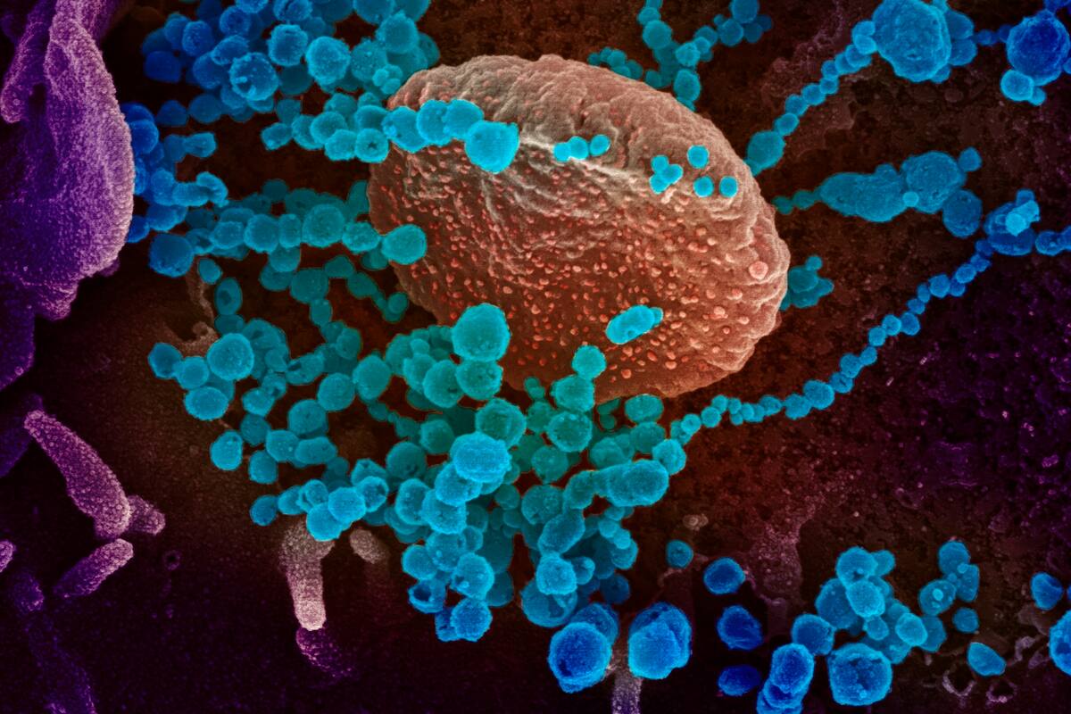 EU asegura que coronavirus se propagará; pide prepararse