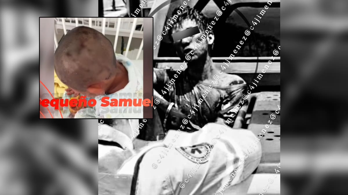 Hombre atacó con machete a menor de 4 años y fue vinculado a proceso por tentativa de homicidio (Imágenes sensibles)