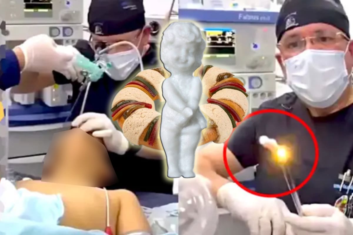 VIRAL: Se traga muñeco de Rosca de Reyes y así se lo extrajeron