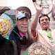 Púas Olivares vende recuerdos para operarse