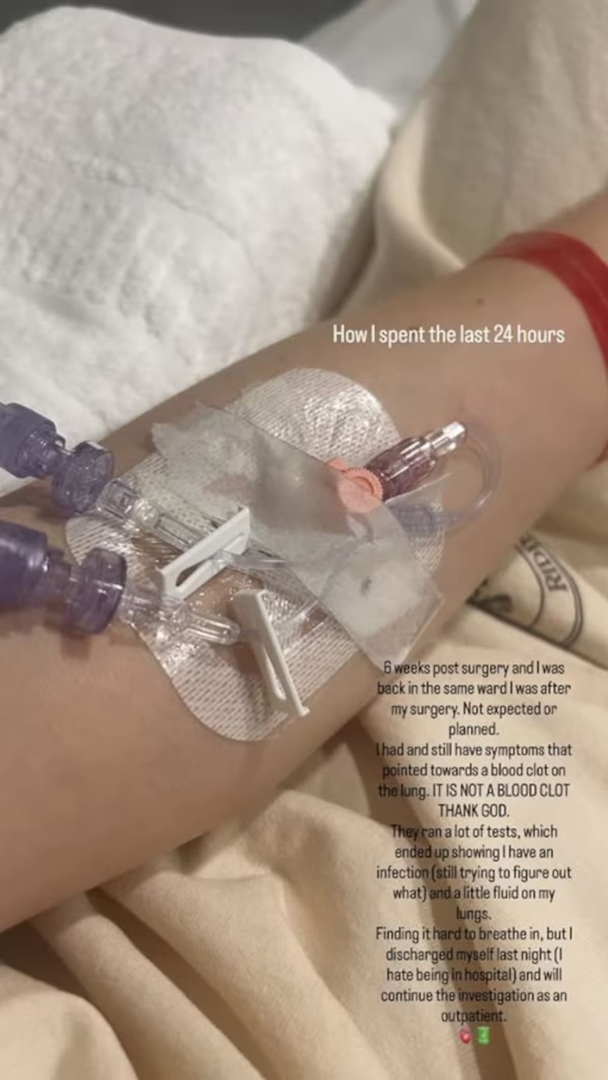 Jessie J regresó a la misma sala de su cirugía de cáncer de mama seis semanas después. | Captura de pantalla: IG @jessiej
