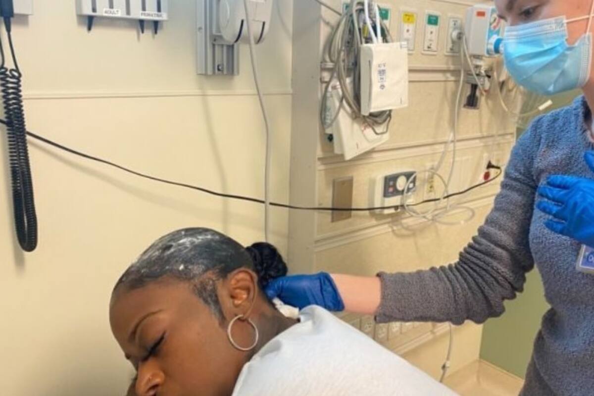 Tras operación de 4 horas quitan pegamento del cabello de la mujer que lo usó en lugar de fijador